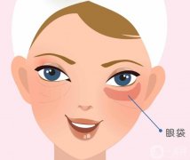 溶脂去除眼袋的恢復(fù)期有多長？