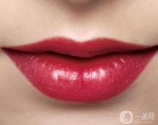 嘴唇太厚怎么變薄?哪些人適合做厚嘴唇變薄術?