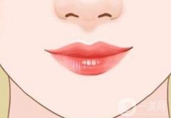 厚嘴唇變薄術適應哪些人群？厚嘴唇變薄術有什么技術優(yōu)勢?