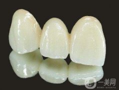 烤瓷牙是怎么鑲嵌的，又如何取下來?