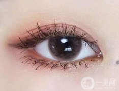 開眼角開的是前面還是后面?