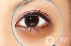 黑眼圈手術(shù)的果好嗎?去除黑眼圈的方法有哪些?