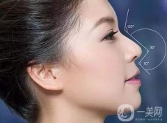 假體隆鼻會不會留下疤痕呢，假體隆鼻*好的材料是什么?