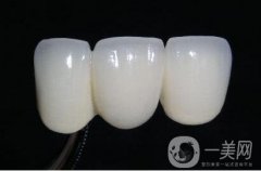 烤瓷牙可以做核磁共振嗎?電動牙刷可以刷烤瓷牙嗎?