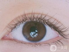 割雙眼皮需要忌口嗎?割雙眼皮的常見誤區(qū)