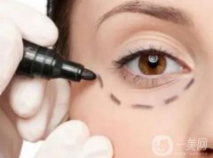 外切眼袋的疤痕需要多長時間恢復(fù)？如何護理？