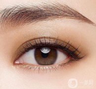 北京埋線雙眼皮多少錢?割雙眼皮適合人群!