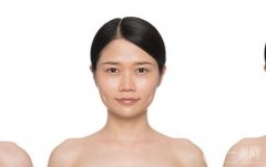 注射注射瘦肩后應(yīng)該注意什么？有風險嗎？