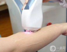 為什么超冰脫毛的痛感更低？是不是*的？