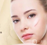 疤痕修復(fù)費(fèi)用是怎么算的呢？術(shù)后護(hù)理注意什么？