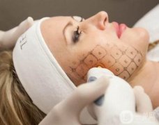 熱瑪吉除皺好不好？哪些人不可以做？