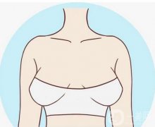 假體隆胸之后能懷孕嗎?