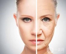 注射注射除皺的步驟是怎么樣的？有哪些注意事項(xiàng)？