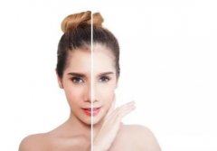 一針*可以白多少？注射*是否*？