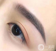 北京雙眼皮多少錢?做雙眼皮影響哪些因素?