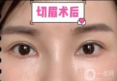 切眉適合哪種年齡的人?