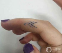 紋身暈開的原因是什么？紋身后的注意事項(xiàng)？