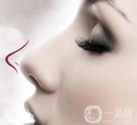 鼻尖肥大有哪些手術(shù)矯正方法?