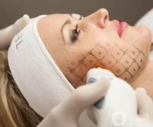 熱瑪吉做哪個(gè)部位果明X？