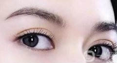 亞韓割雙眼皮多少錢？但這類人群不適合做雙眼皮