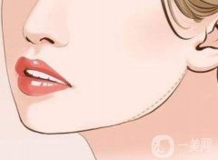 下頜角整形術(shù)全過程！在選擇醫(yī)院的時(shí)候要注意這幾點(diǎn)