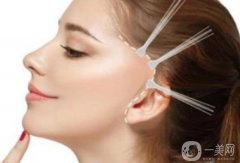 拉皮手術(shù)的果能持續(xù)幾年?拉皮整容需要注意什么?