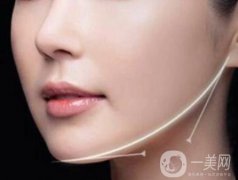 面部吸脂價格是多少?面部吸脂危險嗎?