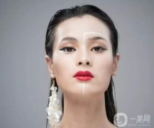 上海鼻翼整形多少錢?鼻翼整形怎么樣?