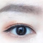 修雙眼皮要多少錢?雙眼皮修復(fù)術(shù)后護(hù)理?