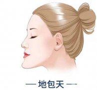 地包天矯正果怎么樣?好不好?