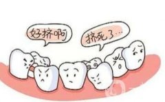 兒童地包天矯正果怎么樣？