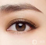 什么類型的眼睛需要修復(fù)?為什么做雙眼皮會(huì)失敗?