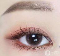 雙眼皮的修復(fù)手術(shù)多少錢?雙眼皮手術(shù)后需要注意什么?