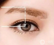 修雙眼皮多少錢?雙眼皮修復(fù)后恢復(fù)快嗎?