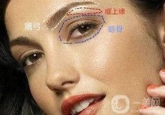 誰做過眉弓隆高?眉弓隆高術是什么?