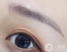 什么是4d提眉術?提眉術有什么果?