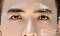 男人做提眉術好嗎?用三角眼做提眉術果好嗎?