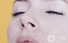 鼻孔整形的方法有哪些呢?