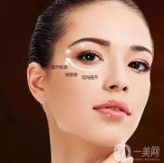 去除眼袋手術(shù)是否需要住院?眼袋手術(shù)的恢復(fù)期有多長(zhǎng)?