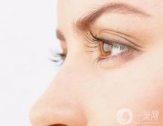 雙眼皮手術(shù)失敗會發(fā)生什么?會導致什么后果?