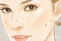 點痣的心得體會