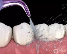 洗牙的誤區(qū)是什么?