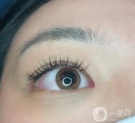 植睫毛是否會(huì)過敏?種植睫毛過敏怎么辦？