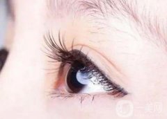 種植睫毛前后需要注意的事項(xiàng)