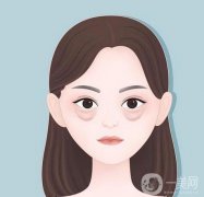 眼袋去除手術(shù)多少錢?去除眼袋有哪些誤區(qū)