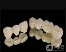 做烤瓷牙的心得體會