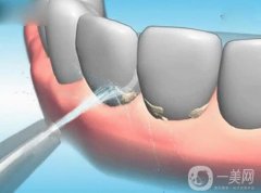 洗牙后牙齦腫痛應(yīng)該怎么辦