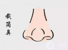 鼻頭縮小需要多少錢?鼻頭縮小有什么優(yōu)缺點