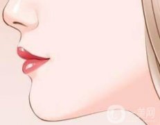 玻尿酸墊下巴會有后遺癥嗎？注射下巴后如何護理