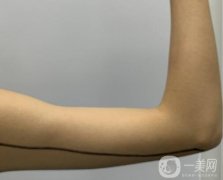 抽脂瘦手臂的風(fēng)險(xiǎn)有什么？